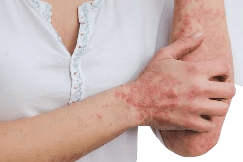 10 Alarming Skin Diseases: Facts for All Ages