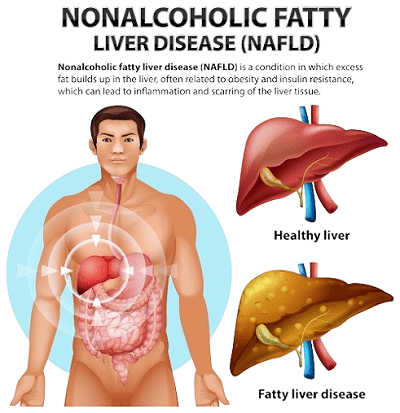 liver dissease symptoms