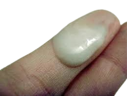 cervical mucus and early pregnancy