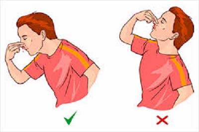 nosebleeds in children