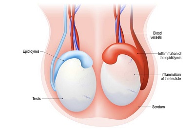 testicular pain teatment