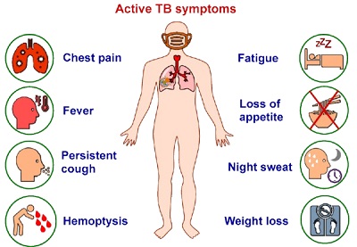 Tuberculosis Reason: 10 Causes and How to Stay Safe