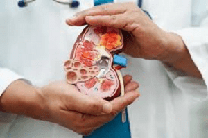 causes of chronic kidney disease