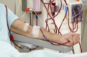 chronic kidney disease