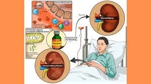 kidney disease treatment