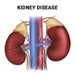 stages of chronic kidney disease