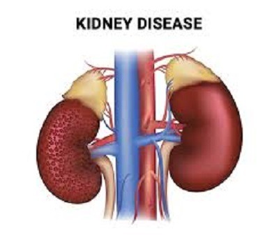 10 Silent Signs of Chronic Kidney Disease You Should Never Ignore