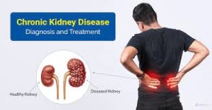 symptoms of chronic kidney disease