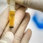 cloudy urine causes