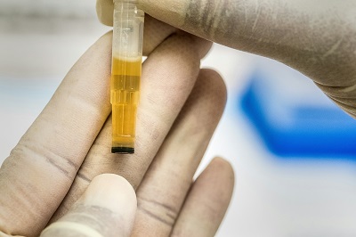 cloudy urine causes