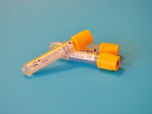 cloudy urine symptoms