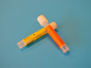what does cloudy urine mean