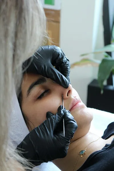 skin tag remover