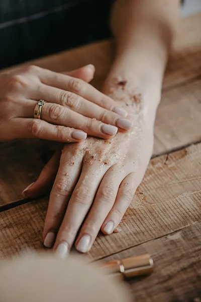 what is the best skin tag remover method